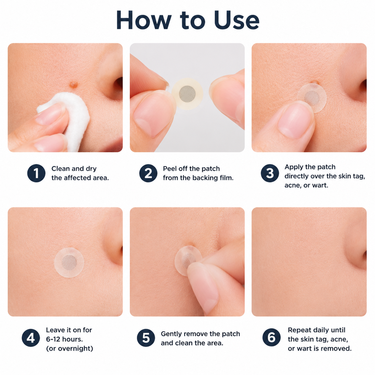 ✨Lumivo®2-in-1 Microneedle & Hydrocolloid Patch🍀| Removes Raised Moles, Acne, Flat Warts & Skin Tags | Helps Improve Wrinkles, Scars & Blemishes | Invisible Patches for Face & Body