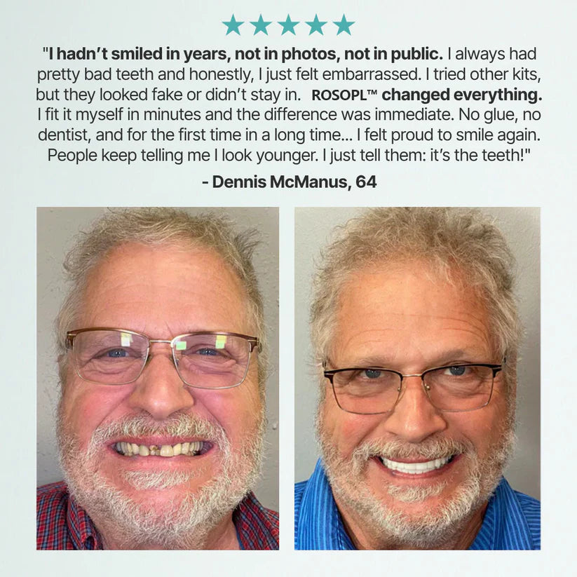 Ends Today: 60% OFF! ⏰pryxo™ Medical Full Denture with Strong Suctiond Custom-Fit Full Functional Dentures🦷Obtain American Dental Association (ADA) Certification