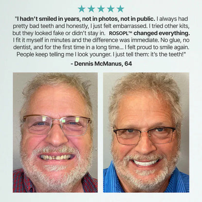 Ends Today: 60% OFF! ⏰pryxo™ Medical Full Denture with Strong Suctiond Custom-Fit Full Functional Dentures🦷Obtain American Dental Association (ADA) Certification