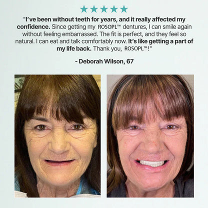 Ends Today: 60% OFF! ⏰pryxo™ Medical Full Denture with Strong Suctiond Custom-Fit Full Functional Dentures🦷Obtain American Dental Association (ADA) Certification