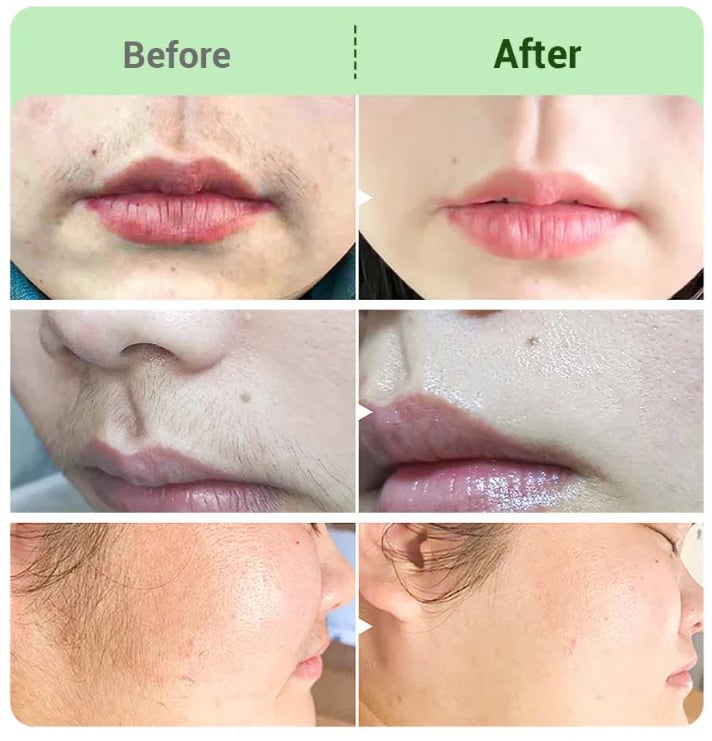 Hair Removal Cream for all wome