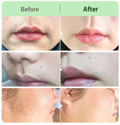 Hair Removal Cream for all wome