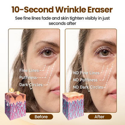 Newyuo® Renewing 10s Wrinkle Serum