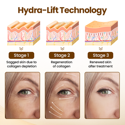 Newyuo® Renewing 10s Wrinkle Serum