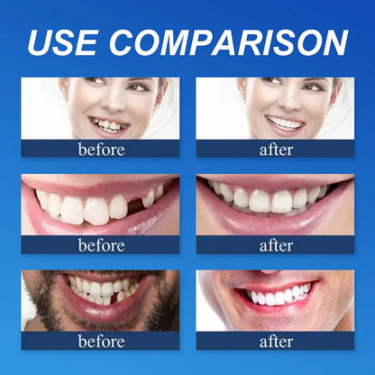 ⏰Yagoo™ Medical Full Denture with Strong Suctiond🦷Obtain American Dental Association (ADA) Certification