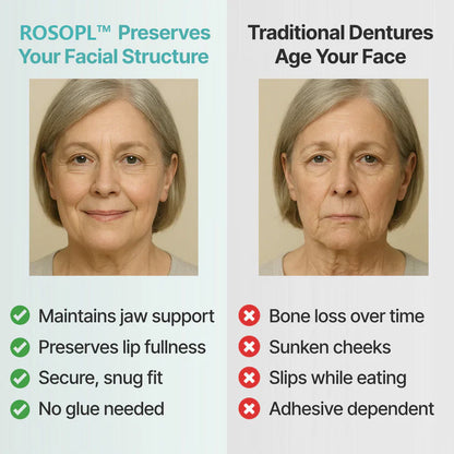 Ends Today: 60% OFF! ⏰pryxo™ Medical Full Denture with Strong Suctiond Custom-Fit Full Functional Dentures🦷Obtain American Dental Association (ADA) Certification