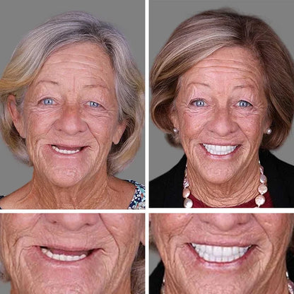 ⏰Yagoo™ Medical Full Denture with Strong Suctiond🦷Obtain American Dental Association (ADA) Certification