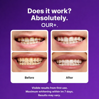 Color-Correct Whitening Strips