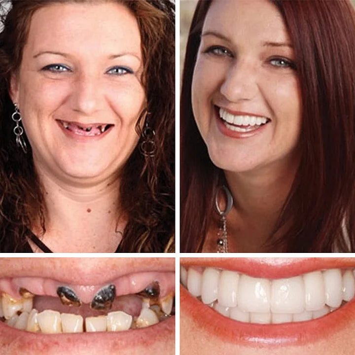 ⏰Yagoo™ Medical Full Denture with Strong Suctiond🦷Obtain American Dental Association (ADA) Certification