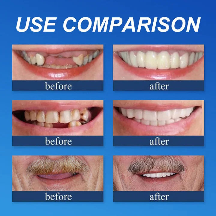 ⏰Yagoo™ Medical Full Denture with Strong Suctiond🦷Obtain American Dental Association (ADA) Certification